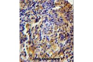 Image no. 2 for anti-Chromosome 11 Open Reading Frame 73 (C11orf73) (AA 9-39), (N-Term) antibody (ABIN950728)