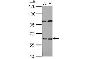 Image no. 4 for anti-Eukaryotic Translation Initiation Factor 3, Subunit D (EIF3D) (Center) antibody (ABIN2855038)