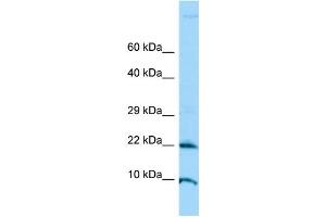 Image no. 1 for anti-Adenosine Deaminase, tRNA-Specific 2 (ADAT2) (N-Term) antibody (ABIN2790513)