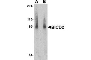 Image no. 1 for anti-Bicaudal D Homolog 2 (BICD2) (Middle Region) antibody (ABIN1030887)