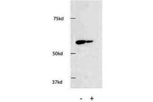 Image no. 4 for anti-Histone Deacetylase 1 (HDAC1) (AA 449-482) antibody (ABIN3031222)