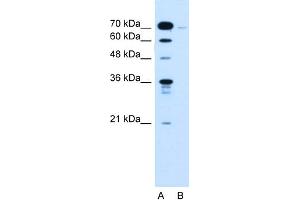 Image no. 1 for anti-Kelch-Like 31 (KLHL31) (C-Term) antibody (ABIN2781877)