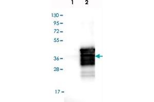 Image no. 3 for anti-SIX Homeobox 1 (SIX1) antibody (ABIN5587955)