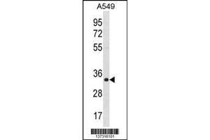 Image no. 1 for anti-Enoyl Coenzyme A Hydratase 1, Peroxisomal (ECH1) (AA 223-250), (C-Term) antibody (ABIN1536876)