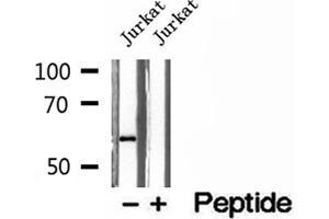 Image no. 1 for anti-phosphoglycerate Dehydrogenase (PHGDH) (N-Term) antibody (ABIN6264177)