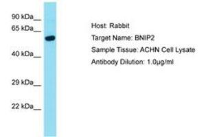 Image no. 1 for anti-BCL2/adenovirus E1B 19kDa Interacting Protein 2 (BNIP2) (AA 152-201) antibody (ABIN6750468)