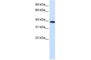 Image no. 2 for anti-Jumonji Domain Containing 6 (JMJD6) (Middle Region) antibody (ABIN2777439)