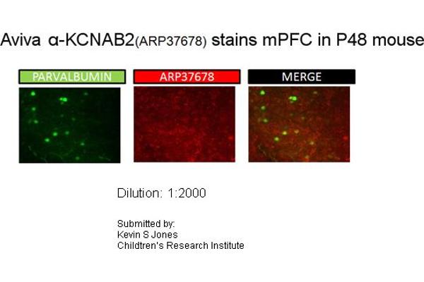 anti-Potassium Voltage-Gated Channel, Shaker-Related Subfamily, beta Member 2 (KCNAB2) (Middle Region) antibody