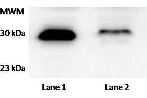 anti-Tetratricopeptide Repeat Domain 33 (TTC33) antibody