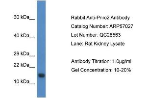 Image no. 1 for anti-Proline Rich Nuclear Receptor Coactivator 2 (PNRC2) (N-Term) antibody (ABIN2787027)