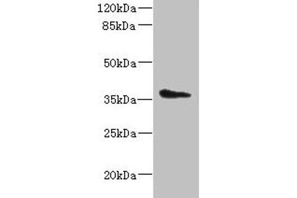 AASDHPPT Antikörper  (AA 1-309)