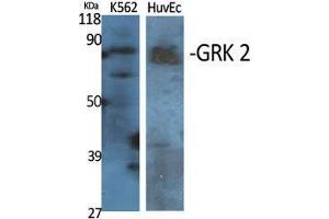 Image no. 2 for anti-Adrenergic, Beta, Receptor Kinase 1 (ADRBK1) (Ser129) antibody (ABIN3184941)