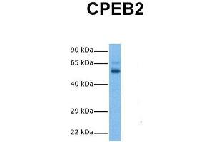 Image no. 2 for anti-Cytoplasmic Polyadenylation Element Binding Protein 2 (CPEB2) (Middle Region) antibody (ABIN2776669)