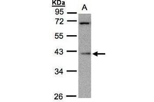 Image no. 1 for anti-Mitochondrial Ribosomal Protein S22 (MRPS22) (Center) antibody (ABIN2856404)