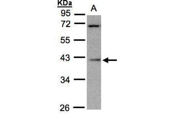anti-Mitochondrial Ribosomal Protein S22 (MRPS22) (Center) antibody