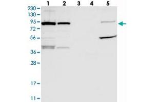 Image no. 2 for anti-UFM1-Specific Ligase 1 (UFL1) antibody (ABIN5590551)