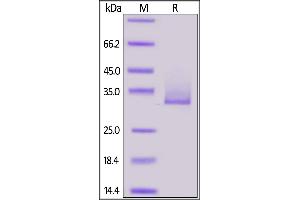 Image no. 2 for Angiopoietin-Like 3 (ANGPTL3) (AA 17-220) (Active) protein (His tag,AVI tag,Biotin) (ABIN6972943)