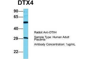 Image no. 1 for anti-Deltex Homolog 4 (Drosophila) (DTX4) (C-Term) antibody (ABIN2791001)