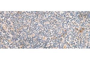 MEST antibody