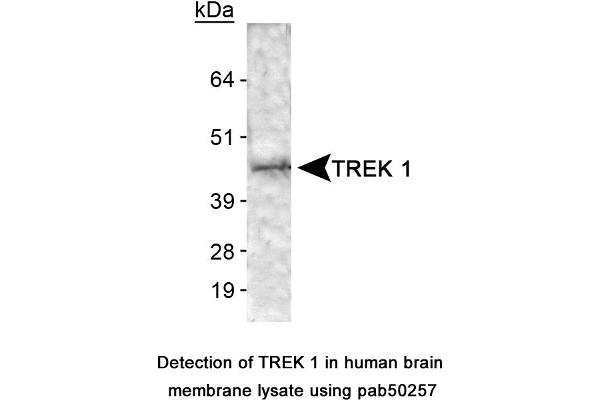 KCNK2 Antikörper  (N-Term)