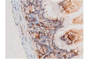 Image no. 2 for anti-Spleen tyrosine Kinase (SYK) (pTyr525) antibody (ABIN6255944)
