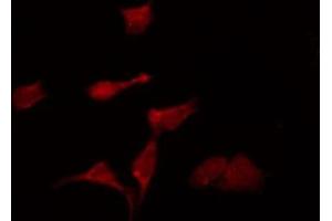 Image no. 2 for anti-Potassium Channel Subfamily K Member 6 (KCNK6) (C-Term) antibody (ABIN6257300)