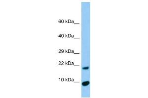 Host:  Rabbit  Target Name:  Timm17a  Sample Type:  Rat Pancreas lysates  Antibody Dilution:  1.