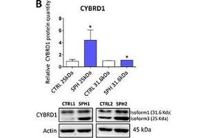 anti-Cytochrome B Reductase 1 (CYBRD1) (AA 51-150) antibody