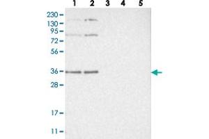 Image no. 2 for anti-Werner Helicase Interacting Protein 1 (WRNIP1) antibody (ABIN5590986)