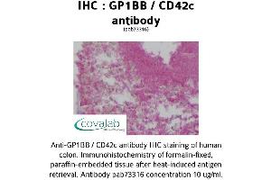 Image no. 1 for anti-Glycoprotein Ib (Platelet), beta Polypeptide (GP1BB) (AA 56-118) antibody (ABIN1734865)