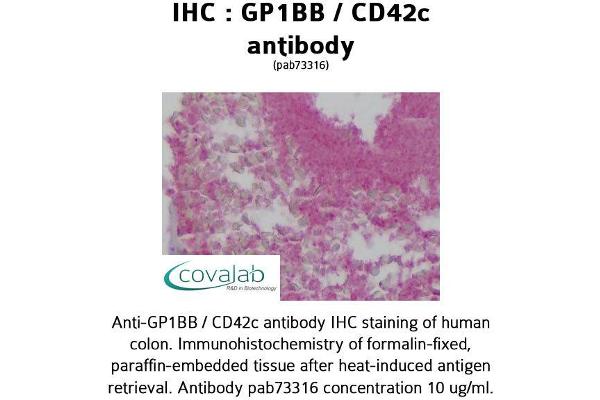 GP1BB Antikörper  (AA 56-118)