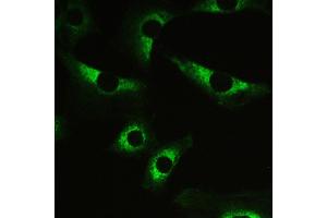 Image no. 4 for anti-Myosin Phosphatase, Target Subunit 1 (PPP1R12A) (AA 1-40), (N-Term) antibody (ABIN3043902)