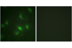 Immunofluorescence analysis of HepG2 cells, using STAT5A/B (Phospho-Ser725/730) Antibody.
