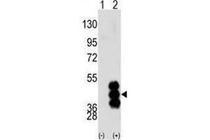 Image no. 3 for anti-phosphorylase Kinase, gamma 2 (Testis) (PHKG2) (N-Term) antibody (ABIN359432)