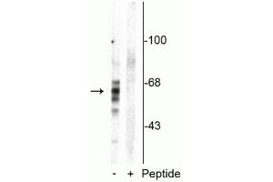 Image no. 2 for anti-Microtubule-Associated Protein tau (MAPT) (pSer416) antibody (ABIN361456)
