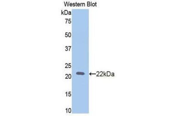 anti-Slit Homolog 2 (Drosophila) (SLIT2) (AA 209-374) antibody