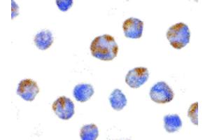 Image no. 3 for anti-NLR Family, Pyrin Domain Containing 1 (NLRP1) (C-Term) antibody (ABIN6655096)