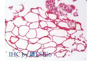 Image no. 1 for anti-Perilipin 4 (PLIN4) (Internal Region) antibody (ABIN2613464)