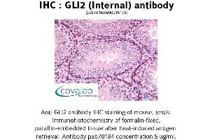 Image no. 1 for anti-GLI Family Zinc Finger 2 (GLI2) (Internal Region) antibody (ABIN1734718)