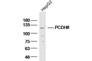 Lane 1: HepG2 lysates probed with Anti PCDH8 Polyclonal Antibody, Unconjugated (bs-11114R) at 1:300 overnight at 4˚C.