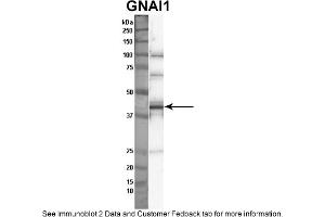 Image no. 1 for anti-Guanine Nucleotide Binding Protein (G Protein), alpha Inhibiting Activity Polypeptide 1 (GNAI1) (Middle Region) antibody (ABIN2785808)