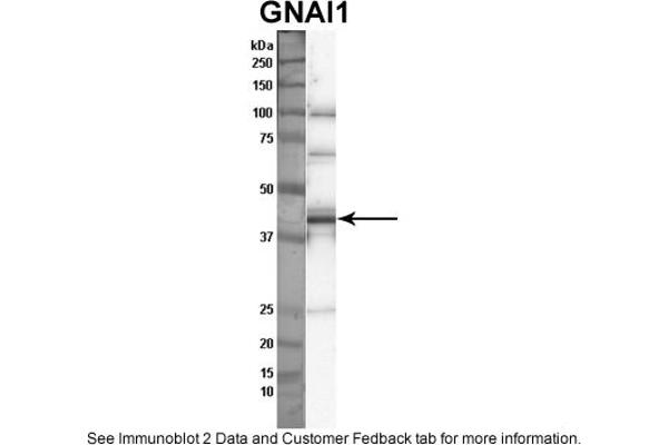 anti-Guanine Nucleotide Binding Protein (G Protein), alpha Inhibiting Activity Polypeptide 1 (GNAI1) (Middle Region) antibody