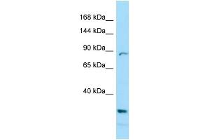 Image no. 1 for anti-Prickle Homolog 2 (PRICKLE2) (C-Term) antibody (ABIN2790041)