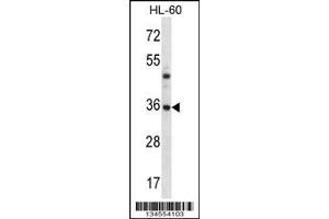 Image no. 1 for anti-Proteasome (Prosome, Macropain) Subunit, beta Type, 8 (Large Multifunctional Peptidase 7) (PSMB8) (N-Term) antibody (ABIN2495400)