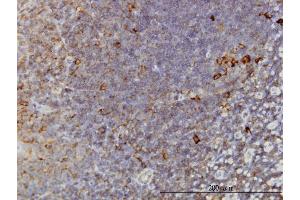 Image no. 5 for anti-T-Complex 1 (TCP1) (AA 1-556) antibody (ABIN563128)