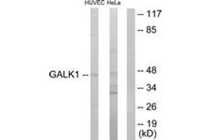 Image no. 1 for anti-Galactokinase 1 (GALK1) (AA 1-50) antibody (ABIN1533758)