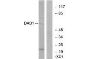 Image no. 1 for anti-Disabled Homolog 1 (Drosophila) (DAB1) (AA 187-236) antibody (ABIN1532843)