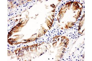 Image no. 2 for anti-Integrin beta 4 (ITGB4) (AA 28-266) antibody (ABIN3042525)