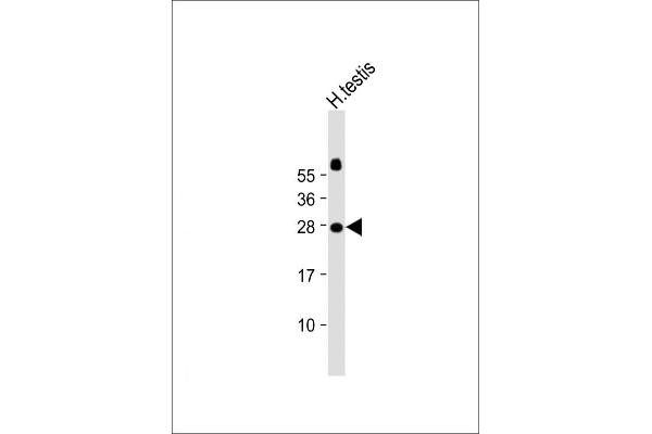 JAZF1 Antikörper  (N-Term)