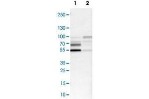 Image no. 2 for anti-Nuclear Factor I/B (NFIB) antibody (ABIN5584434)